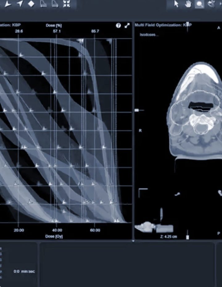 Radiotherapy dose planning view